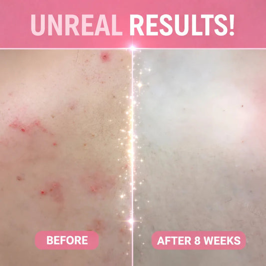 Ozylon™ Bath Peeling SPA Exfoliating Glove